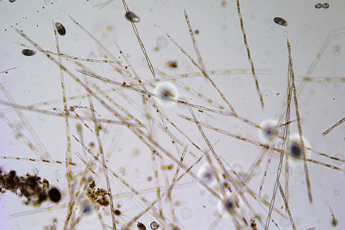 Algae from the genus Pseudo-nitzschia, some species of which are responsible for producing domoic acid