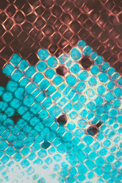 Chloroplasts in eelgrass die as a wasting disease infection spreads